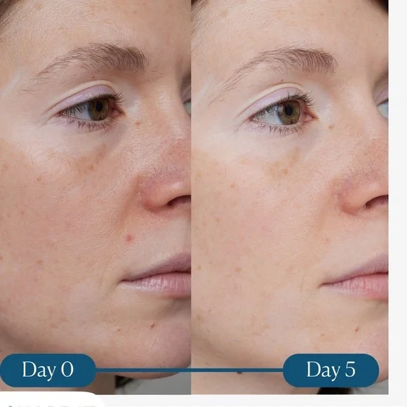 Dynamic Resurfacing Super-C Serum